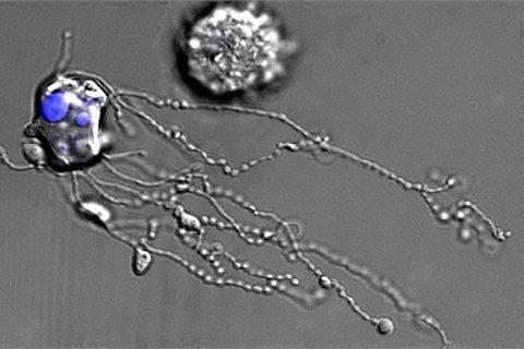 Hình ảnh "độc" về cái chết của tế bào bạch cầu