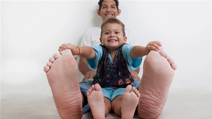 Choáng với chàng trai khổng lồ có đôi bàn chân dài nhất thế giới