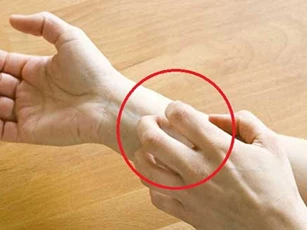 Thấy cơ thể xuất hiện điều này, cảnh báo bạn đang ngập trong độc tố