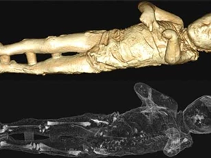 Giải mã bí ẩn bên trong các xác ướp thạch cao Pompeii 2.000 năm tuổi