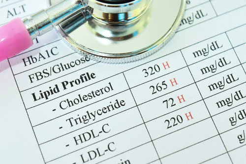 Nếu muốn giữ gìn sức khỏe và ngăn ngừa bệnh tật, chị em hãy đập tan những quan niệm sai lầm về cholesterol này