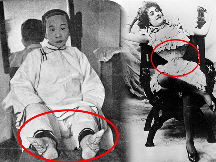 Rợn tóc gáy với các tiêu chuẩn làm đẹp của phụ nữ cổ xưa