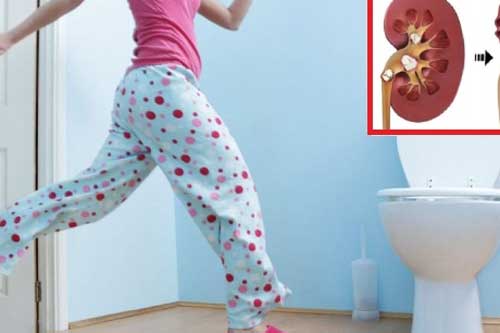 Cơ thể xuất hiện 5 dấu hiệu lạ, coi chừng bị suy thận mạn tính