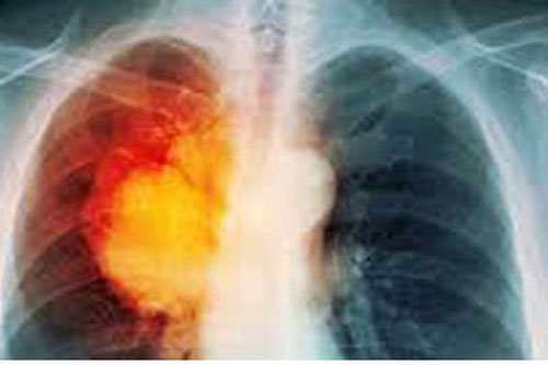 Si&#xEA;u th&#x1EF1;c ph&#x1EA9;m c&#xF3; th&#x1EC3; l&#xE0;m s&#x1EA1;ch nicotine trong ph&#x1ED5;i