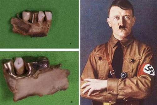 Nghiên cứu về răng của Hitler xác nhận ông ta có nhiều khả năng là người ăn chay