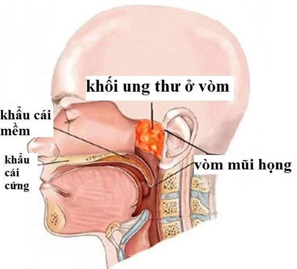 Đây là món cá nhiều người ưa thích được WHO xếp vào nhóm gây ung thư số 1, hãy dừng ăn ngay nếu không muốn mắc ung thư - Ảnh 4.