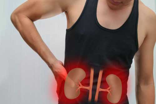 Có biểu hiện này bạn cần đi khám sỏi thận ngay