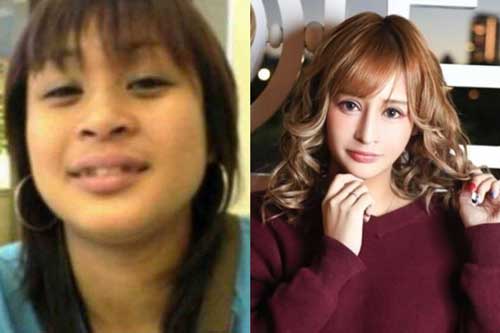 Bị chế giễu xấu như khỉ đột, cô gái cắn răng chịu đựng hơn 100 ca phẫu thuật trong 10 năm để trở thành tiếp viên nổi tiếng nhất Nhật Bản