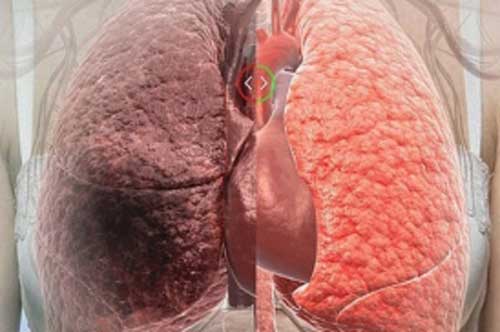 Ăn thực phẩm chưa tới 2 ngàn này, mọi độc tố trong phổi được thải hết, vòng 2 thon gọn