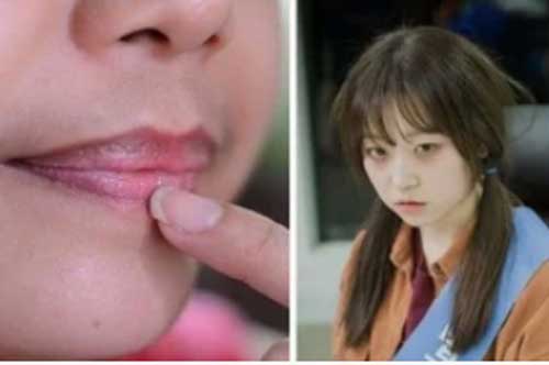 Thấy 4 dấu hiệu này trên mặt rất có thể bạn đang mắc bệnh phụ khoa, nên đi khám gấp