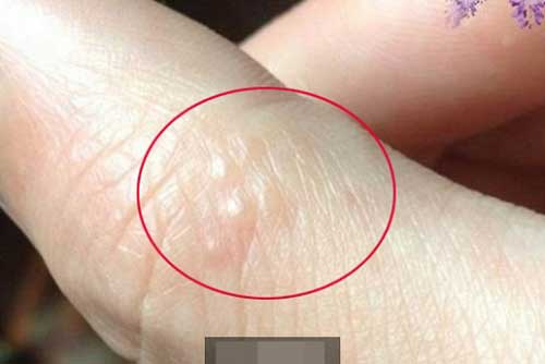 Khi bạn nhìn thấy dấu hiệu này trên cơ thể hãy tới bệnh viện ngay kẻo hối hận thì đã muộn