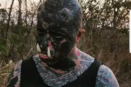 Người đàn ông chi hơn 120 triệu đồng để lắp thêm "bộ ngà"