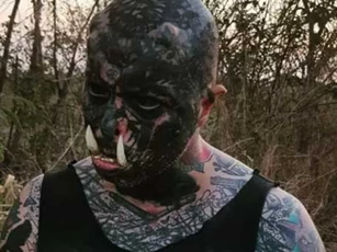 Người đàn ông chi hơn 120 triệu đồng để lắp thêm "bộ ngà"