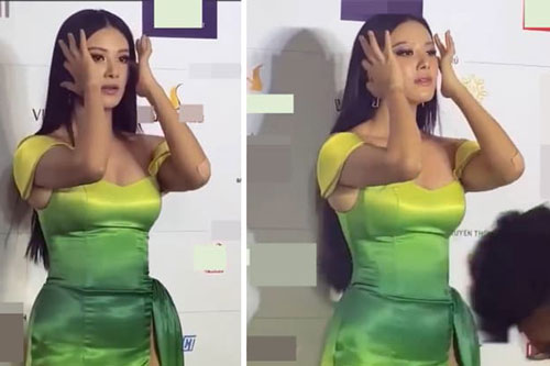 Hậu nghi án phẫu thuật thẩm mỹ, Á hậu Kim Duyên lại bị soi thân hình phát tướng