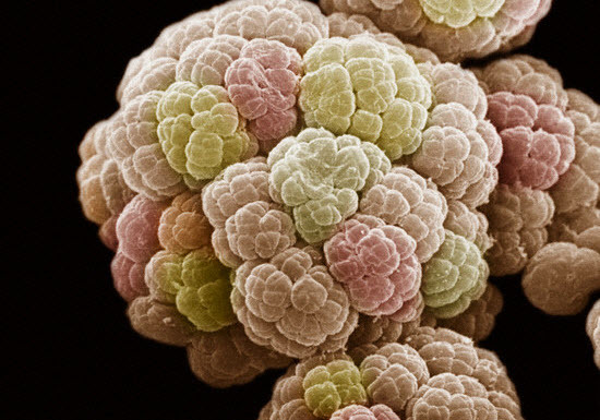 Vi khuẩn gây ra đại tuyệt chủng trên Trái Đất