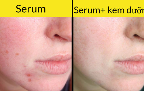 8 sai lầm khiến sản phẩm làm đẹp phản tác dụng