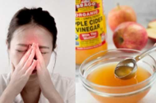 Giấm táo kết hợp cùng 1 nguyên liệu có sẵn trong bếp, có ngay ly nước trị viêm xoang cực hiệu quả