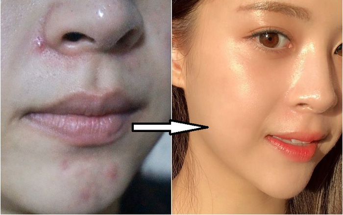 6 thói quen giúp da đẹp lên mỗi ngày mà không cần tốn tiền mua mỹ phẩm