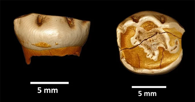 Chiếc răng lạ tiết lộ đứa trẻ y hệt nhưng không phải loài người chúng ta - Ảnh 1.