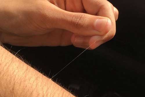 Tại sao một số sợi lông trên cơ thể lại mọc dài tới mức vô lý?