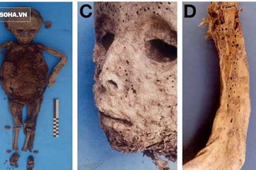 Hé lộ bí ẩn về căn bệnh đáng sợ trong quá khứ nhờ xác ướp 450 tuổi