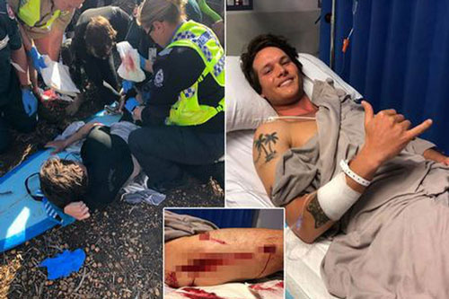 Bị cá mập tấn công bất ngờ, chàng trai nhanh trí làm 2 việc và thoát chết trong gang tấc