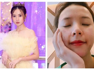 Midu tiết lộ từng giam mình một tháng, đăng luôn ảnh xấu nhất với mặt đầy mụn