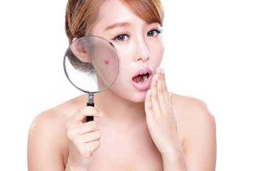 5 suy nghĩ sai lầm về mụn trứng cá khiến da xuống cấp hơn mỗi ngày