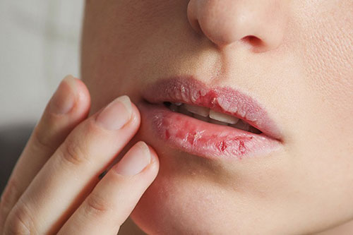 2 loại dầu giúp môi mềm mại chỉ trong 1 đêm