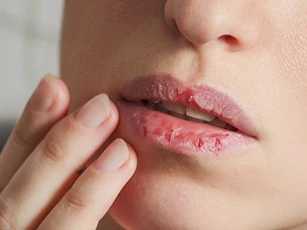 2 loại dầu giúp môi mềm mại chỉ trong 1 đêm