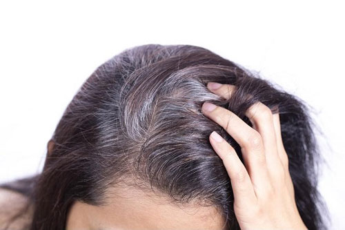 Cần loại bỏ ngay những điều này nếu không muốn tóc bị bạc sớm