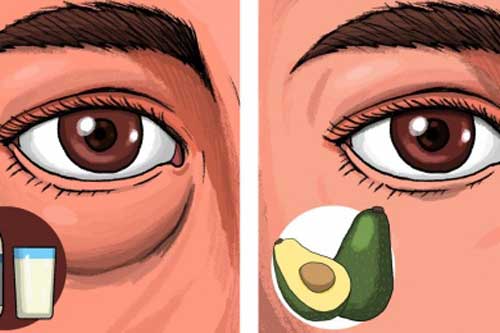 Tránh xa những thực phẩm có thể gây sưng và thâm mắt