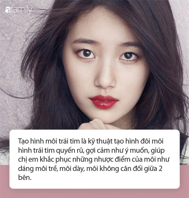 Tạo hình môi trái tim chúm chím, xinh yêu: Thắc mắc ai cũng băn khoăn được chuyên gia giải đáp - Ảnh 2. Tạo hình môi trái tim chúm chím, xinh yêu: Thắc mắc ai cũng băn khoăn được chuyên gia giải đáp - Ảnh 2.