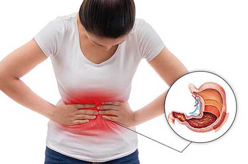 4 biểu hiện tưởng bình thường sau ăn nhưng là dấu hiệu bệnh đau dạ dày