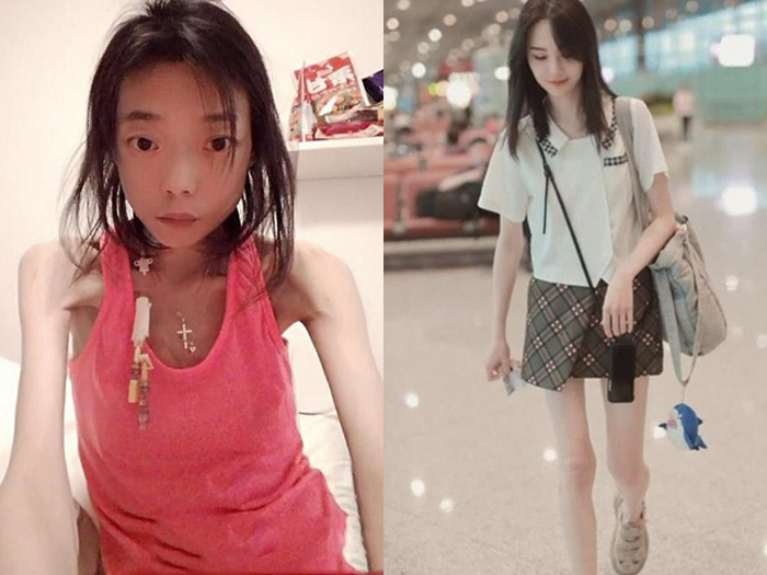 Mỹ nhân hủy hoại nhan sắc vì tình: Người già đi chục tuổi, người bị vứt bỏ, da bọc xương