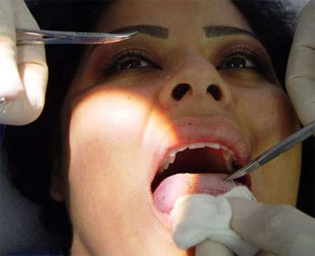 Sáng kiến giảm cân kỳ quái nhất Trái Đất