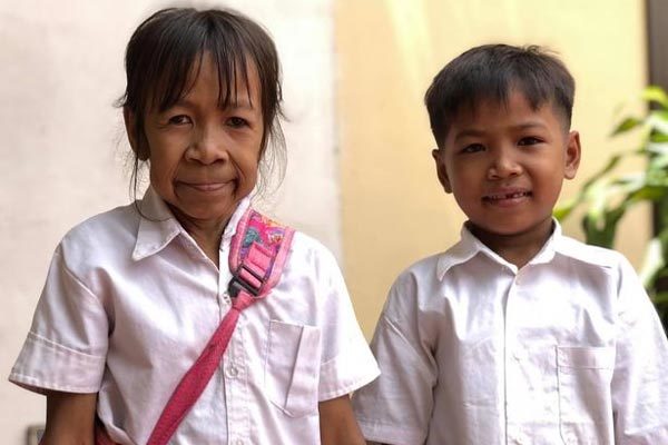 Chuyện lạ: Bé gái có khuôn mặt già như bà lão