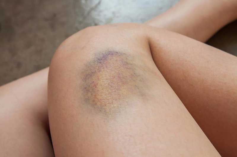 Thấy cơ thể có những dấu hiệu này thì hãy đi khám ngay kẻo ung thư 'ghé thăm'