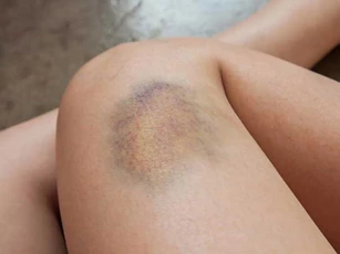 Thấy cơ thể có những dấu hiệu này thì hãy đi khám ngay kẻo ung thư 'ghé thăm'
