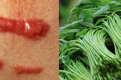 5 đại kỵ khi ăn rau muống gây ngộ độc, hại thận