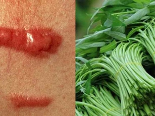5 đại kỵ khi ăn rau muống gây ngộ độc, hại thận