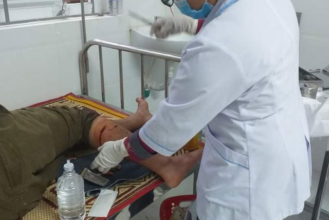 Bị voọc gáy trắng hung hãn tấn công, người đàn ông phải khâu 8 mũi