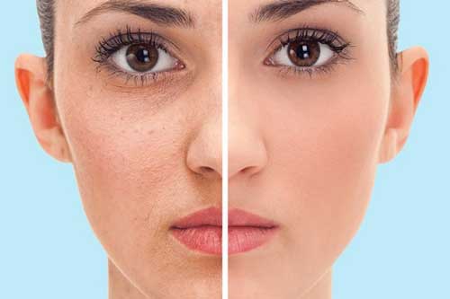 Điều gì xảy ra với làn da khi tắm nước lạnh thường xuyên?