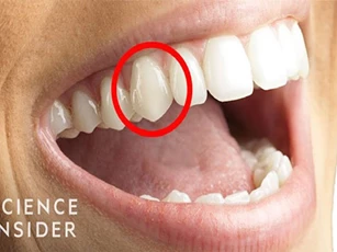 CLIP: Răng nanh của con người có nguồn gốc từ đâu?