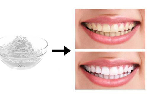 Bật mí 6 cách làm trắng răng cho bạn nụ cười tỏa sáng