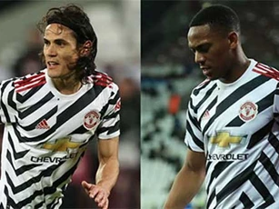 Cavani và Martial chấn thương trước thềm trận sinh tử M.U - Leipzig