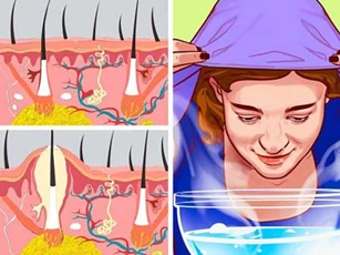 Điều gì xảy ra khi xông hơi mặt mỗi tuần 1 lần?