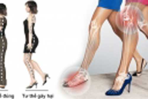 Chị em đi giày cao gót để đẹp nhưng khiến 4 bộ phận trên cơ thể dễ bị biến dạng, đau đớn