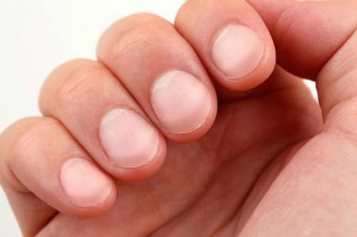 Những dấu hiệu bất thường từ móng tay báo hiệu cơ thể có bệnh