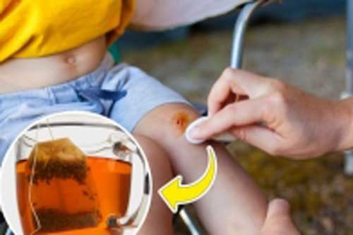 8 công dụng hữu ích của túi lọc trà nhiều người bỏ phí